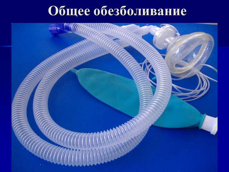 Общее обезболивание